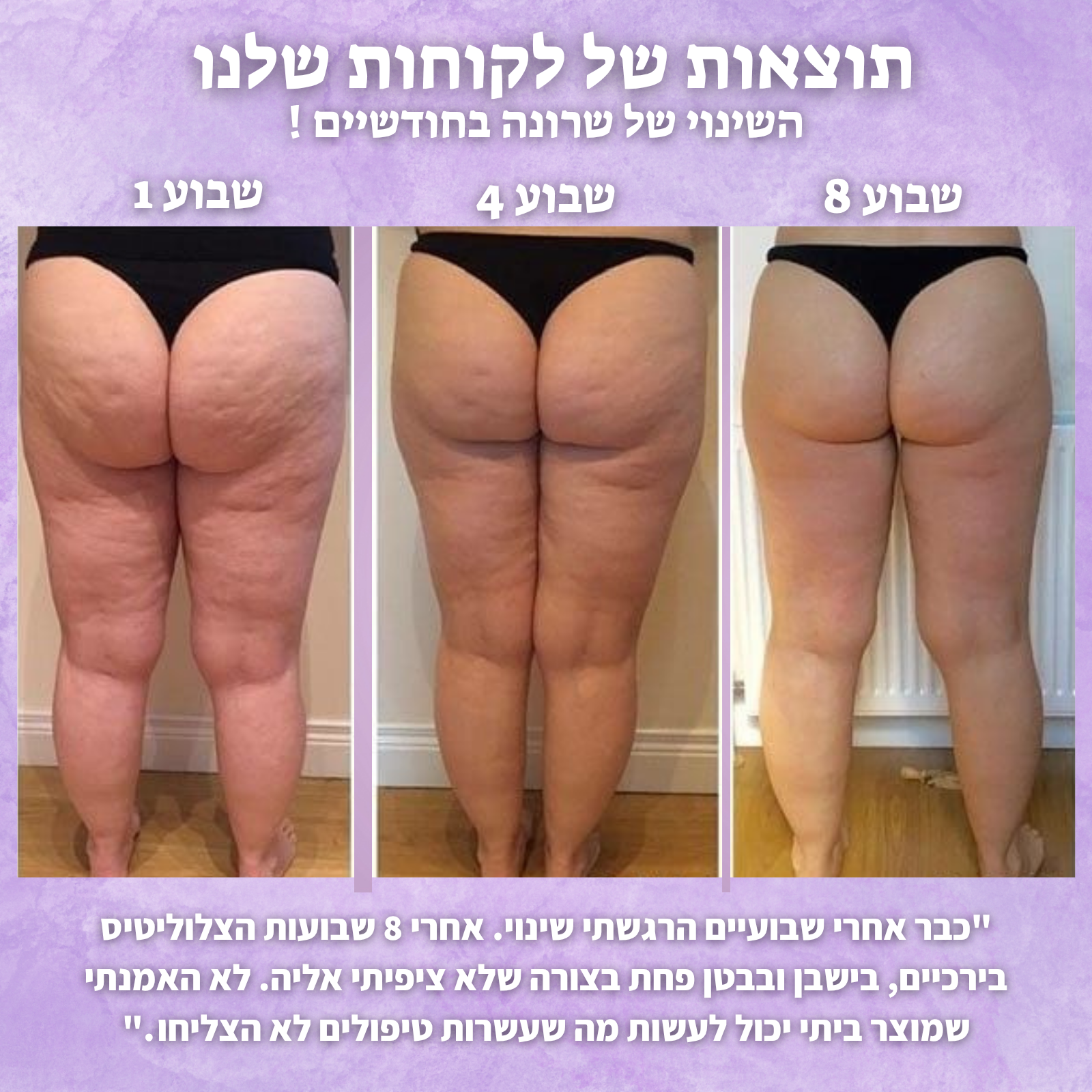 מארז ההחלקה של - glowin🤍