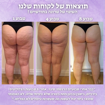 מארז ההחלקה של - glowin🤍