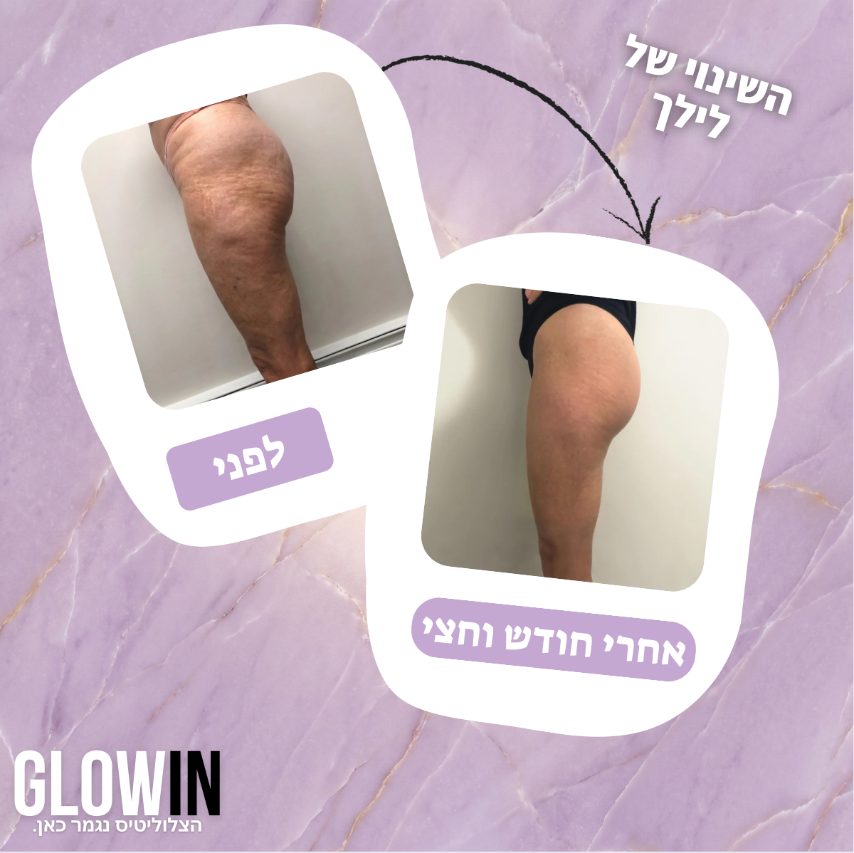 מארז ההחלקה של - glowin🤍